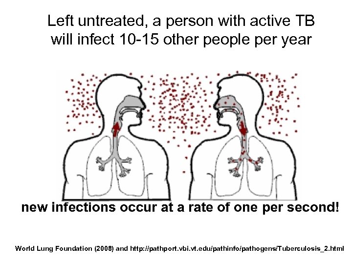 Left untreated, a person with active TB will infect 10 -15 other people per