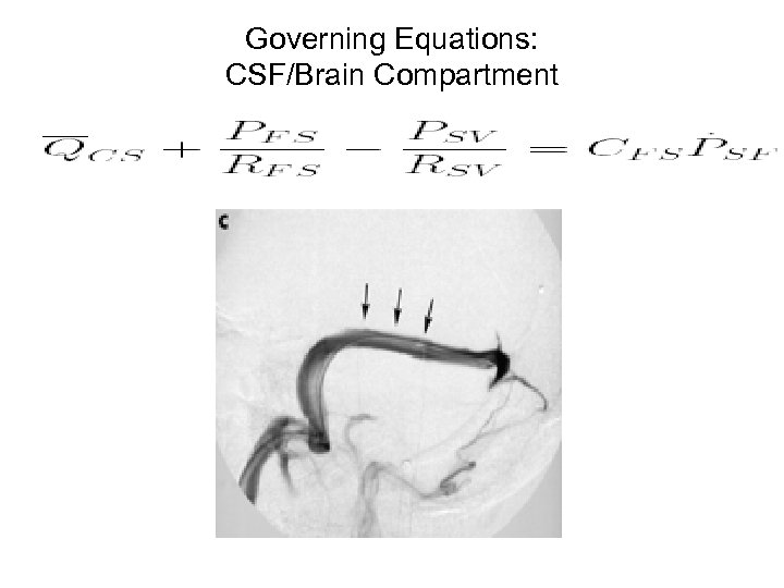 Governing Equations: CSF/Brain Compartment 