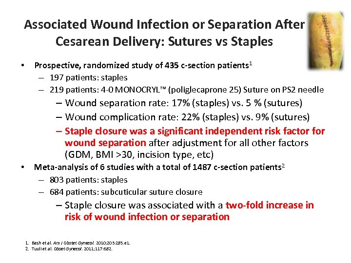 Associated Wound Infection or Separation After Cesarean Delivery: Sutures vs Staples • Prospective, randomized
