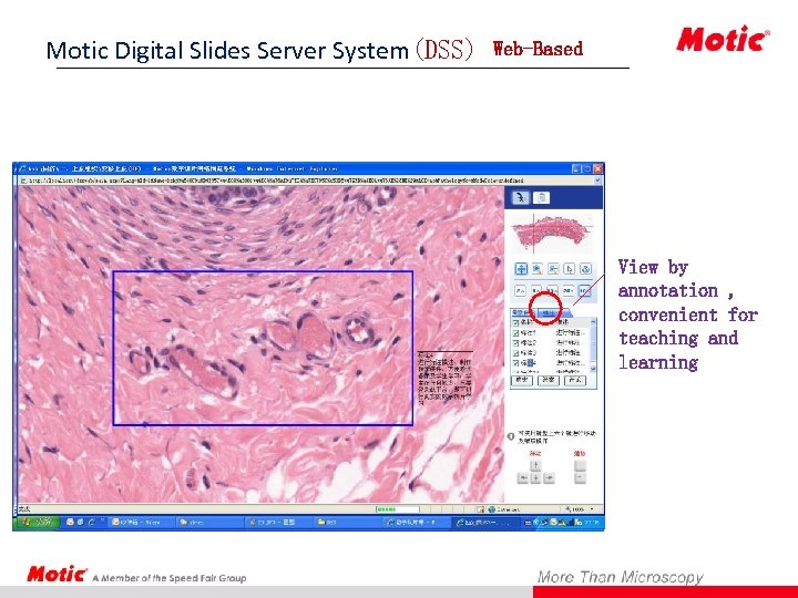 Motic Digital Slides Server System(DSS) System Web-Based View by annotation , convenient for teaching