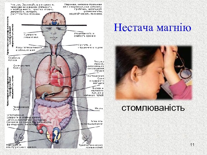 Нестача магнію стомлюваність 11 