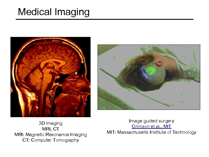 Medical Imaging 3 D imaging MRI, CT MRI: Magnetic Resonance Imaging CT: Computer Tomography