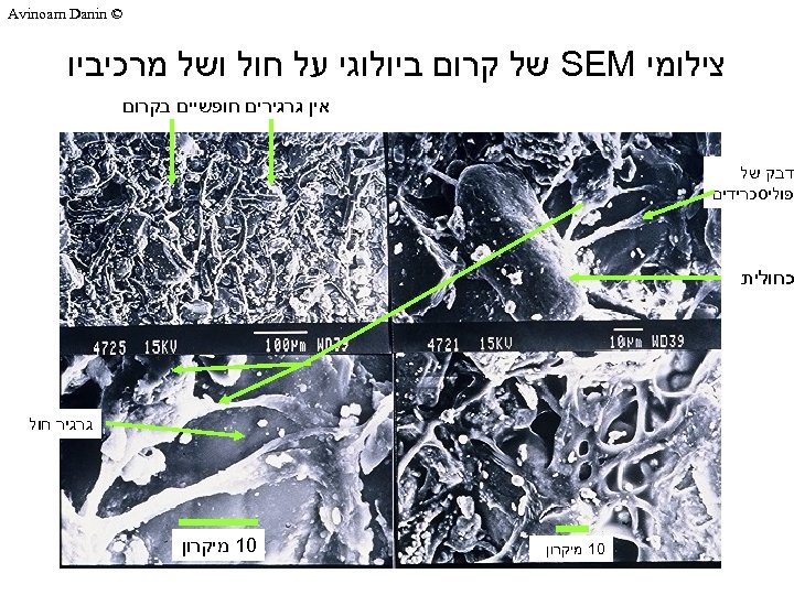  © Avinoam Danin צילומי SEM של קרום ביולוגי על חול ושל מרכיביו אין