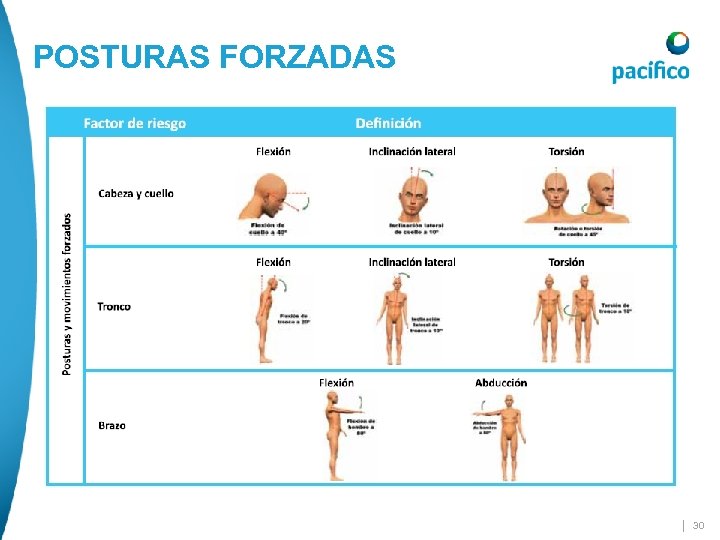 POSTURAS FORZADAS | 30 