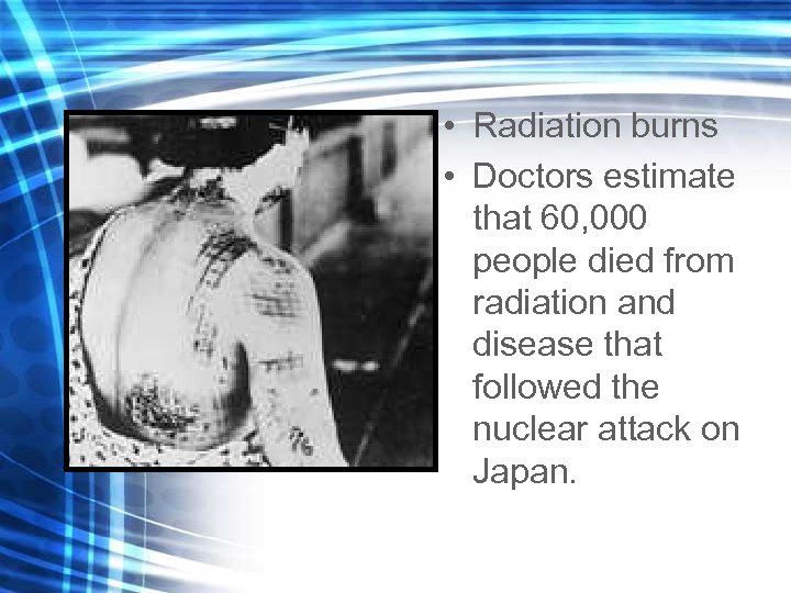  • Radiation burns • Doctors estimate that 60, 000 people died from radiation