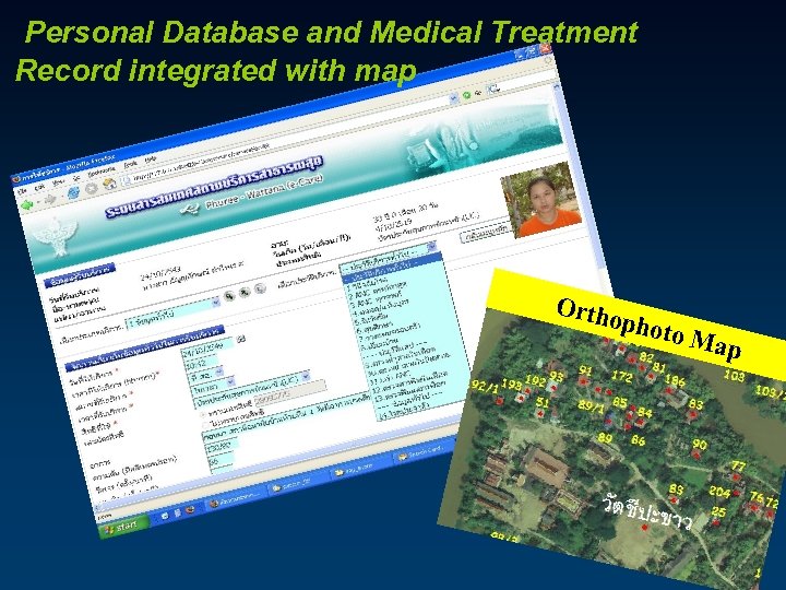 Personal Database and Medical Treatment Record integrated with map Orth opho to Ma p