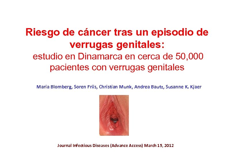 Riesgo de cáncer tras un episodio de verrugas genitales: estudio en Dinamarca en cerca