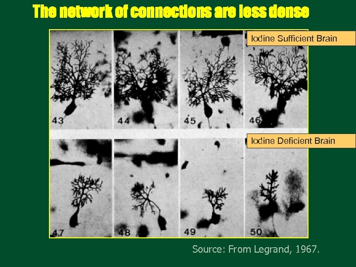 The network of connections are less dense Iodine Sufficient Brain Iodine Deficient Brain Source: