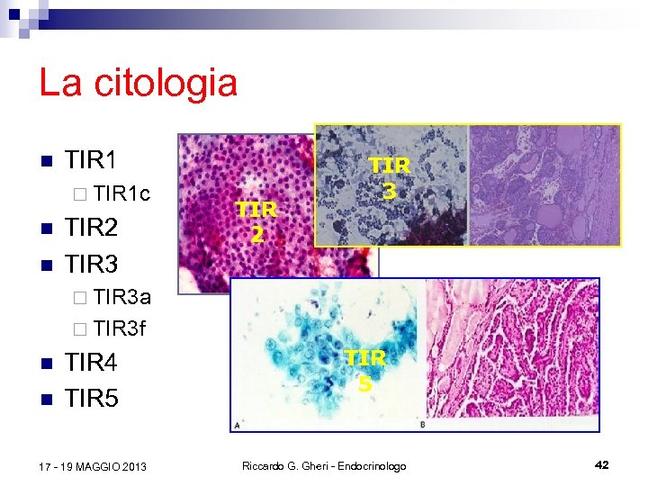 La citologia n TIR 1 ¨ TIR 1 c n n TIR 2 TIR