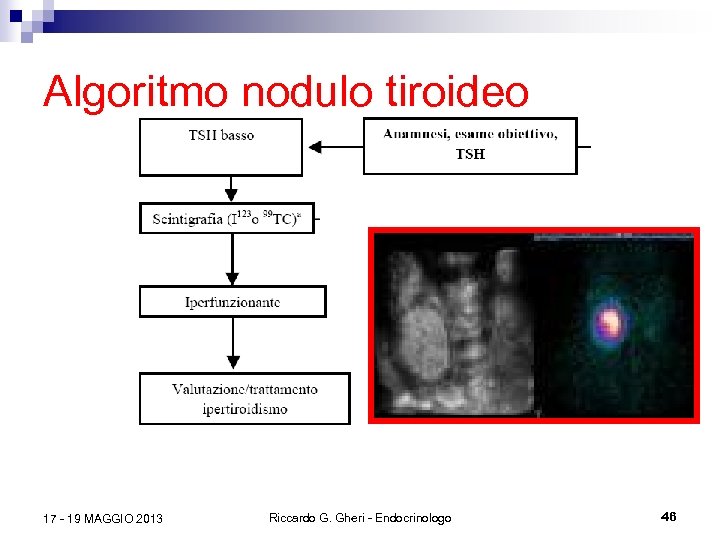 Algoritmo nodulo tiroideo 17 - 19 MAGGIO 2013 Riccardo G. Gheri - Endocrinologo 46