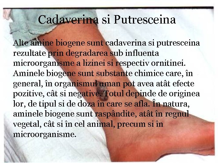 Cadaverina si Putresceina Alte amine biogene sunt cadaverina si putresceina rezultate prin degradarea sub