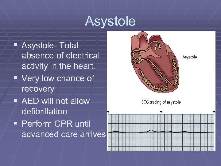 Asystole § Asystole- Total absence of electrical activity in the heart. § Very low