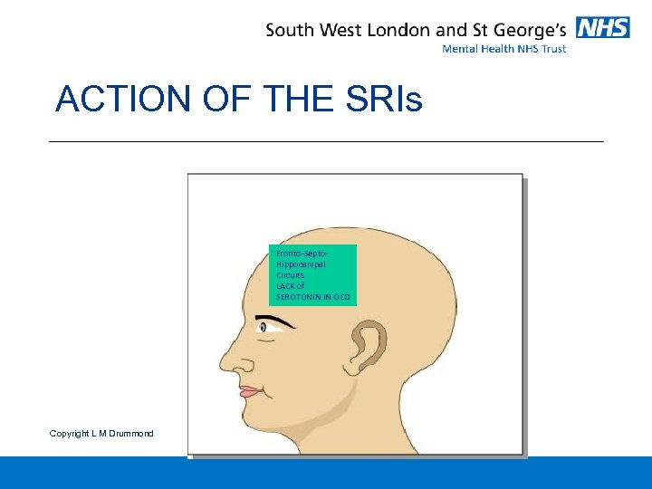 ACTION OF THE SRIs Fronto-Septo. Hippocampal Circuits LACK of SEROTONIN IN OCD Copyright L