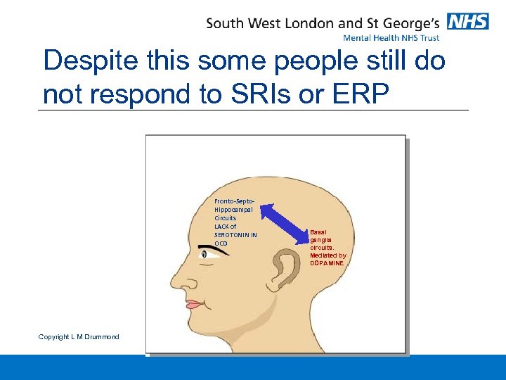 Despite this some people still do not respond to SRIs or ERP Fronto-Septo. Hippocampal