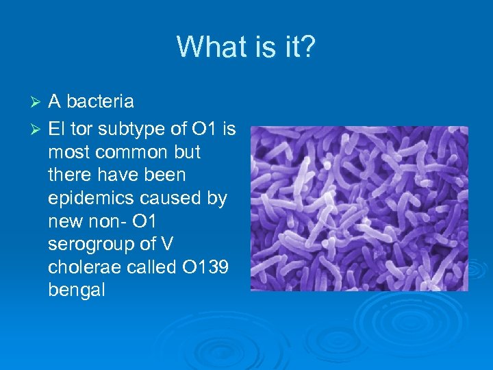 What is it? A bacteria Ø El tor subtype of O 1 is most