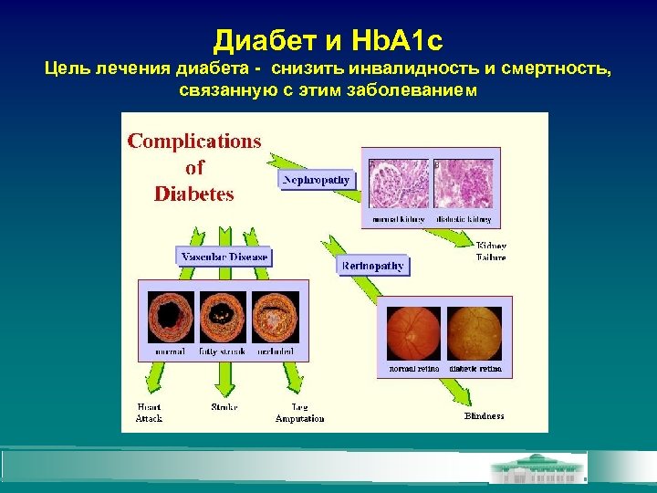 Диабет и Hb. A 1 c Цель лечения диабета - снизить инвалидность и смертность,