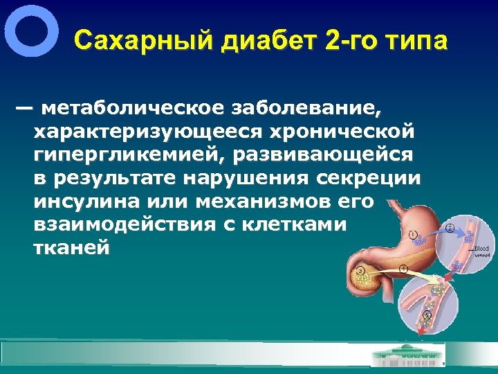 Сахарный диабет 2 -го типа — метаболическое заболевание, характеризующееся хронической гипергликемией, развивающейся в результате