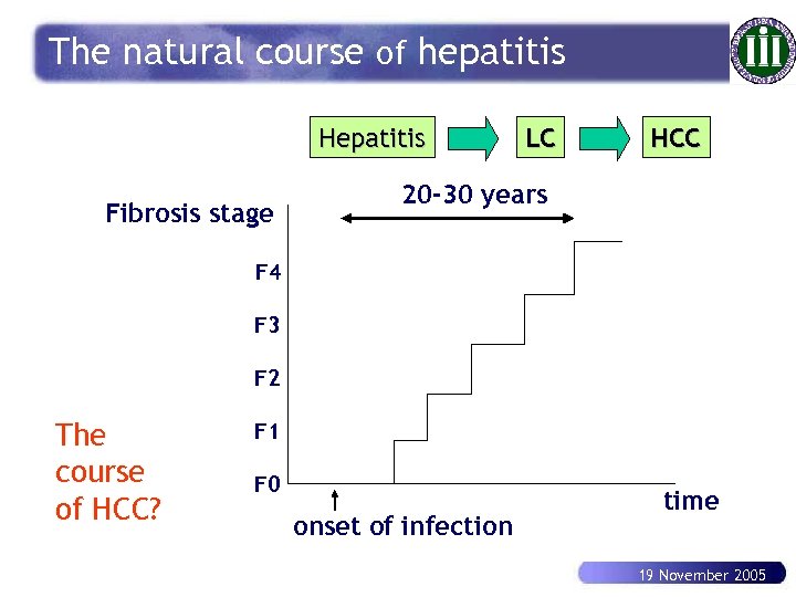 The natural course of hepatitis Hepatitis Fibrosis stage LC HCC 20 -30 years F