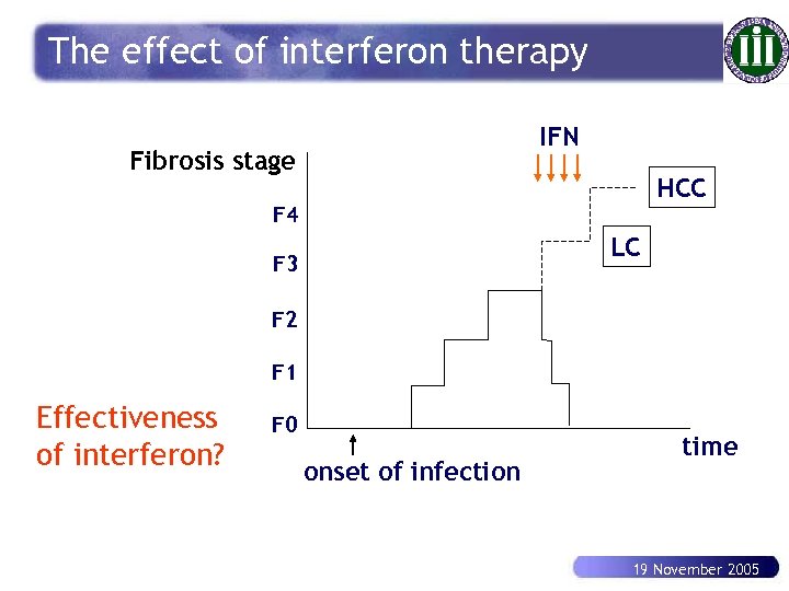 The effect of interferon therapy IFN Fibrosis stage HCC F 4 LC F 3