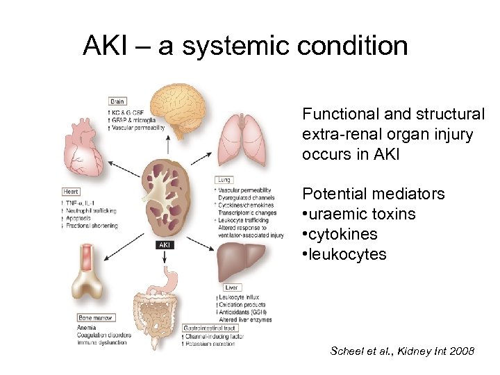 AKI – a systemic condition Functional and structural extra-renal organ injury occurs in AKI