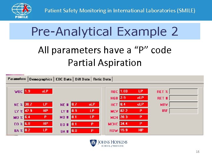 Patient Safety Monitoring in International Laboratories (SMILE) Pre-Analytical Example 2 All parameters have a