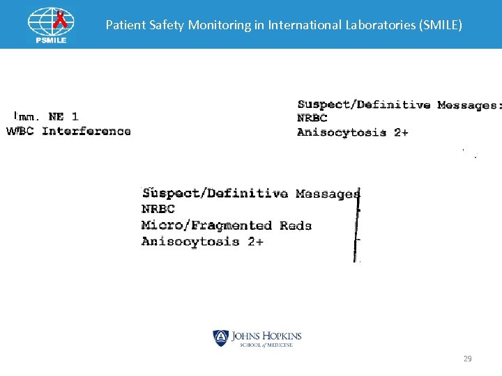 Patient Safety Monitoring in International Laboratories (SMILE) I W 29 