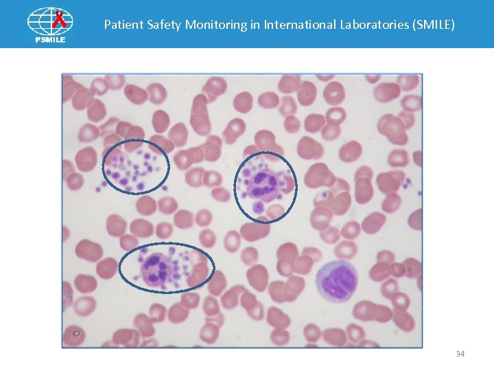 Patient Safety Monitoring in International Laboratories (SMILE) 34 