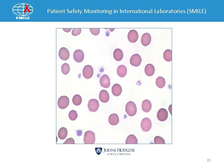 Patient Safety Monitoring in International Laboratories (SMILE) 35 