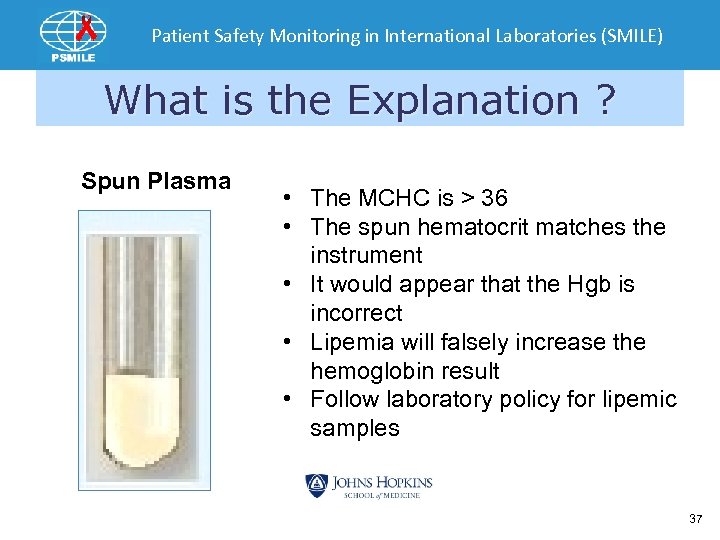 Patient Safety Monitoring in International Laboratories (SMILE) What is the Explanation ? Spun Plasma