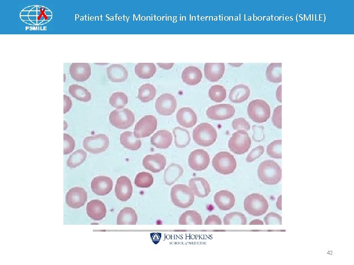 Patient Safety Monitoring in International Laboratories (SMILE) 42 