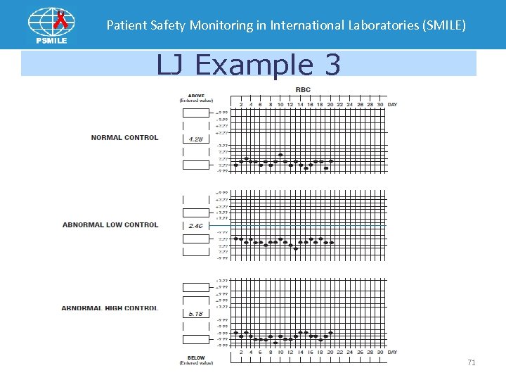 Patient Safety Monitoring in International Laboratories (SMILE) LJ Example 3 71 