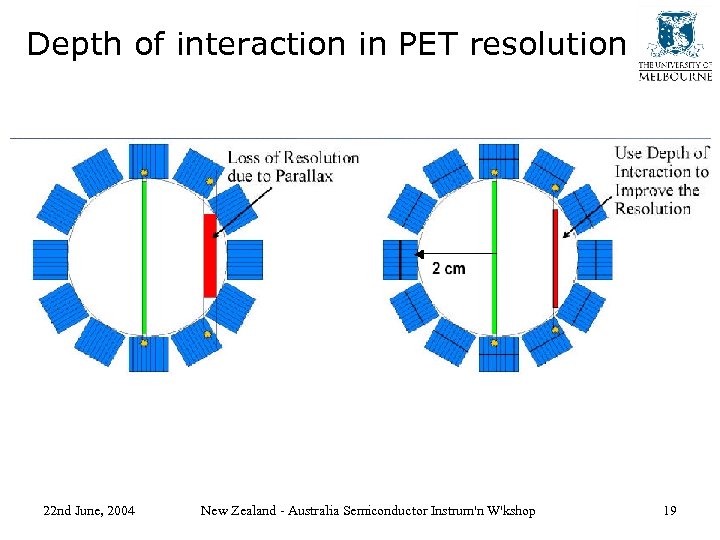Depth of interaction in PET resolution 22 nd June, 2004 New Zealand - Australia