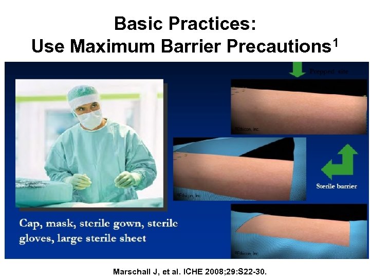 Basic Practices: Use Maximum Barrier Precautions 1 Marschall J, et al. ICHE 2008; 29: