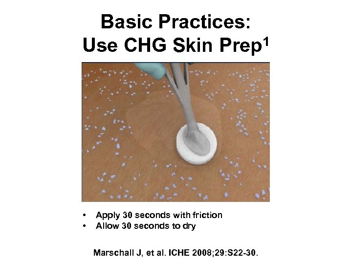 Basic Practices: Use CHG Skin Prep 1 • • Apply 30 seconds with friction