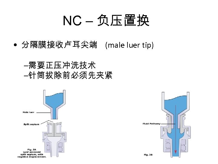 NC – 负压置换 • 分隔膜接收卢耳尖端 (male luer tip) –需要正压冲洗技术 –针筒拔除前必须先夹紧 