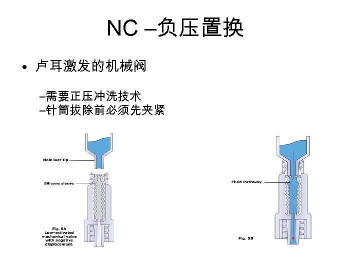 NC –负压置换 • 卢耳激发的机械阀 –需要正压冲洗技术 –针筒拔除前必须先夹紧 