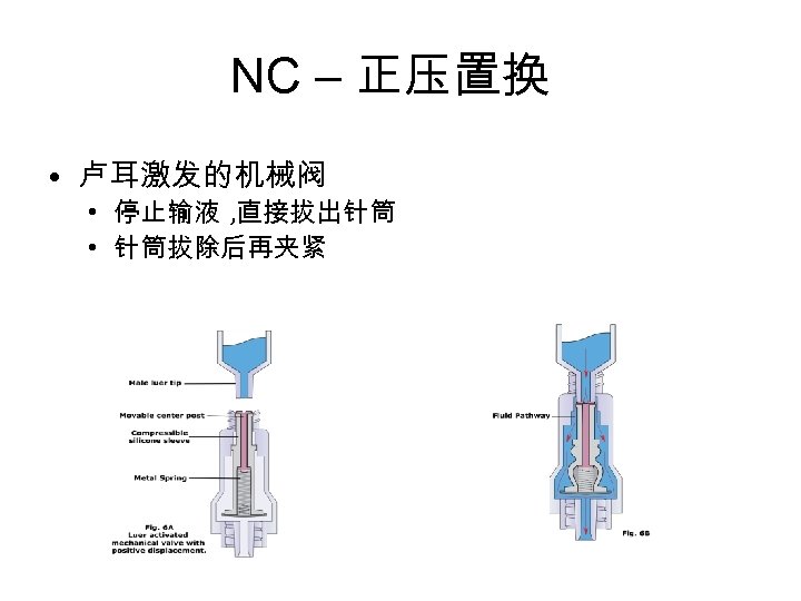 NC – 正压置换 • 卢耳激发的机械阀 • 停止输液 , 直接拔出针筒 • 针筒拔除后再夹紧 