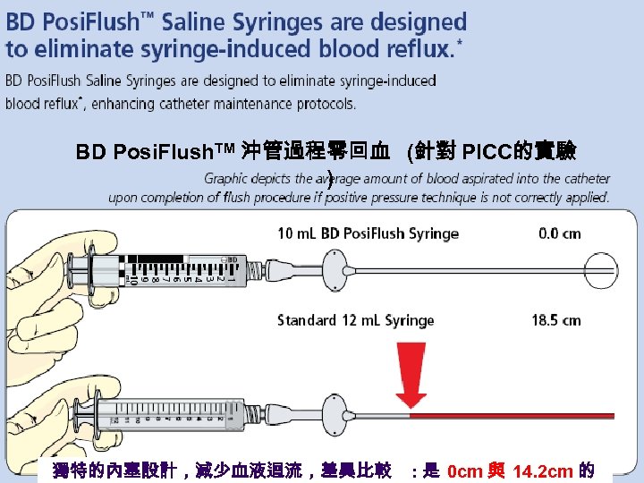 BD Posi. Flush. TM 沖管過程零回血 (針對 PICC的實驗 ) 獨特的內塞設計，減少血液迴流，差異比較 : 是 0 cm 與