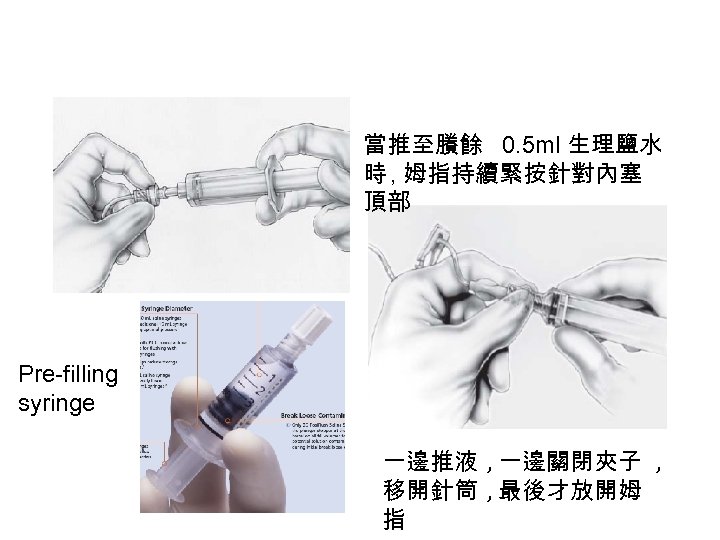 當推至賸餘 0. 5 ml 生理鹽水 時 , 姆指持續緊按針對內塞 頂部 Pre-filling syringe 一邊推液 , 一邊關閉夾子