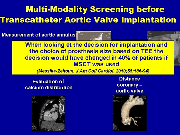 Multi-Modality Screening before Transcatheter Aortic Valve Implantation Measurement of aortic annulus When looking at