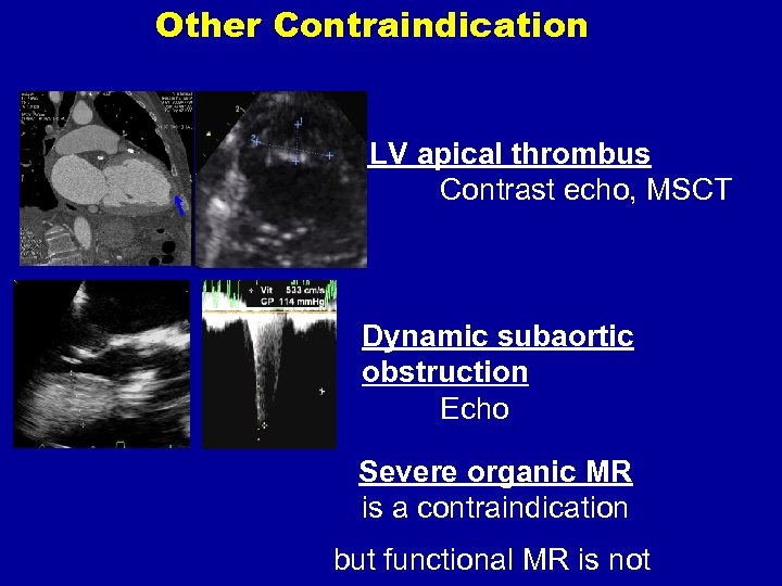 Other Contraindication LV apical thrombus Contrast echo, MSCT Dynamic subaortic obstruction Echo Severe organic