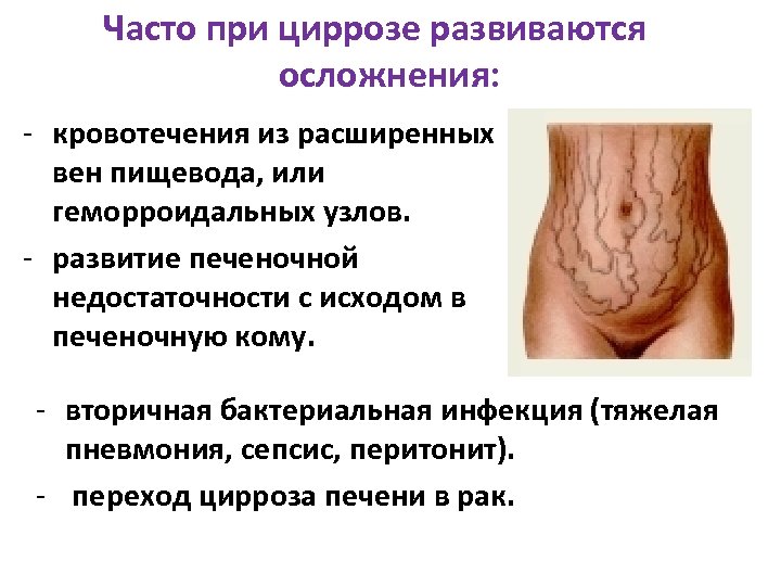 Часто при циррозе развиваются осложнения: - кровотечения из расширенных вен пищевода, или геморроидальных узлов.