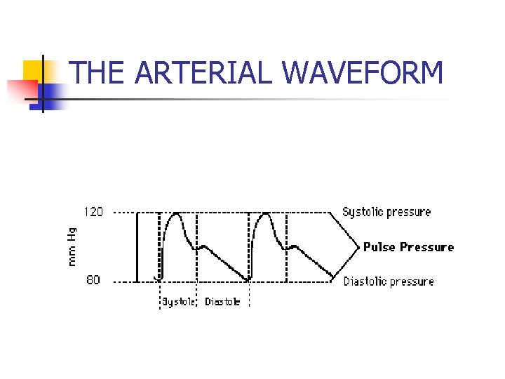 THE ARTERIAL WAVEFORM 