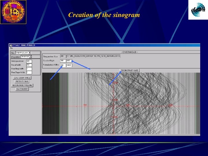 Creation of the sinogram 