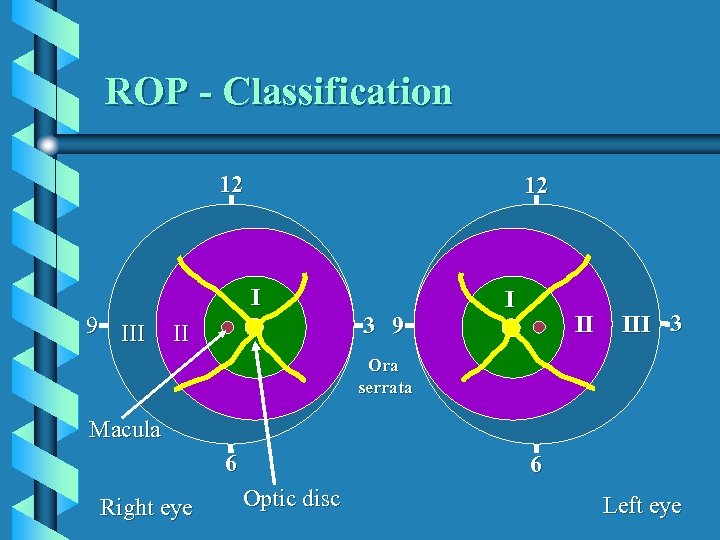 ROP - Classification 12 9 III 12 I 3 9 II I I II