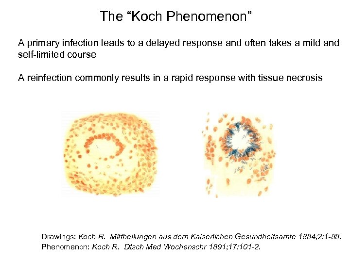 The “Koch Phenomenon” A primary infection leads to a delayed response and often takes