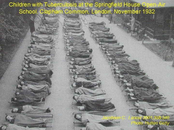 Children with Tuberculosis at the Springfield House Open-Air School, Clapham Common, London, November 1932