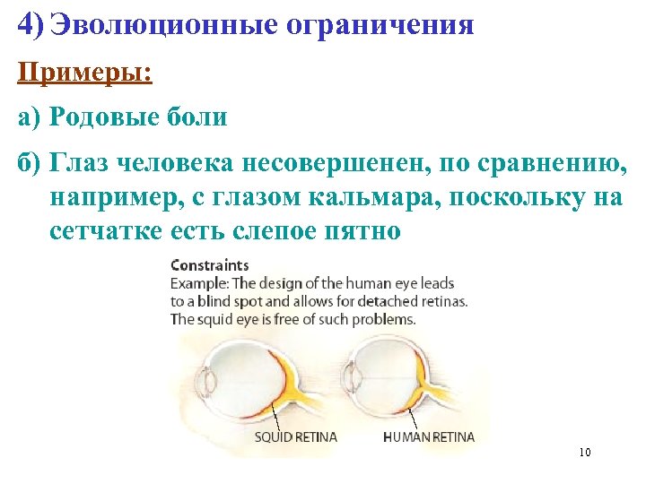 4) Эволюционные ограничения Примеры: а) Родовые боли б) Глаз человека несовершенен, по сравнению, например,