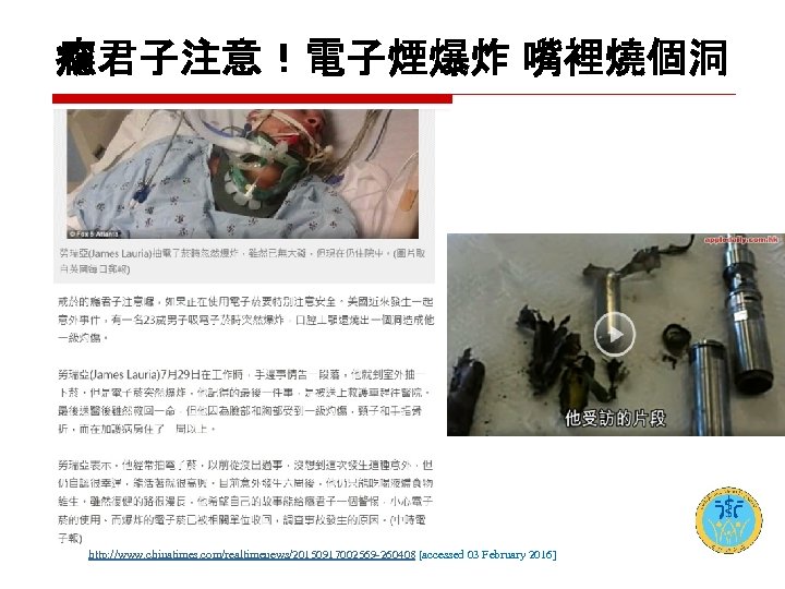 癮君子注意！電子煙爆炸 嘴裡燒個洞 http: //www. chinatimes. com/realtimenews/20150917002569 -260408 [accessed 03 February 2016] 