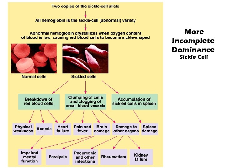 More Incomplete Dominance Sickle Cell 